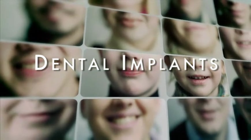 Dental Implants Video