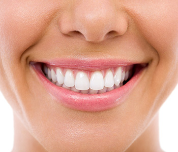 Cosmetic Dental Bonding in Waterloo ON area