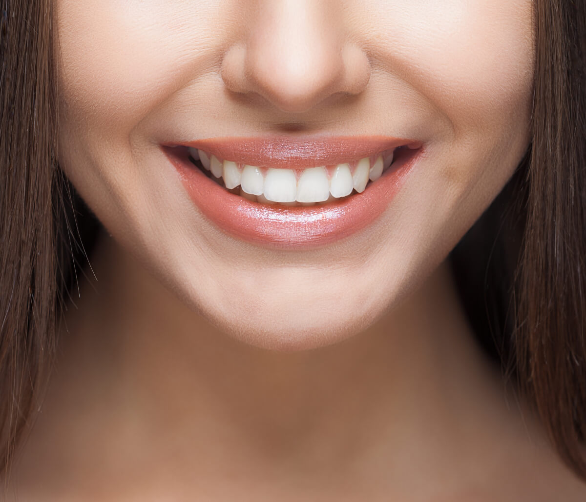 Teeth Bonding Service Waterloo ON area